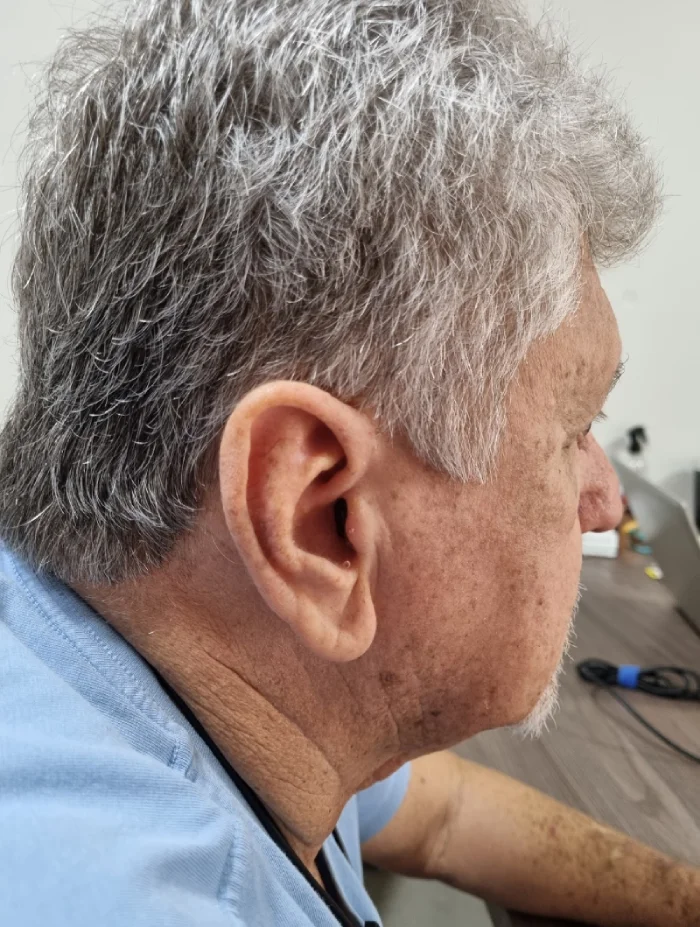 Teste de aparelho auditivo