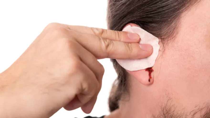 Tímpano perfurado: o que é, causas, sintomas e tratamentos Tímpano perfurado: o que é, causas, sintomas e tratamentos